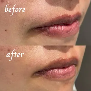 アイブロウ 高野 紗南のエステ・リラクイメージ