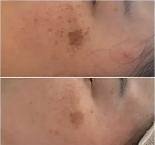 シミケア E Lashのエステ・リラクイメージ