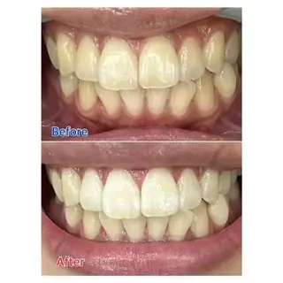 M渋谷 ホワイトニングのエステ・リラクイメージ