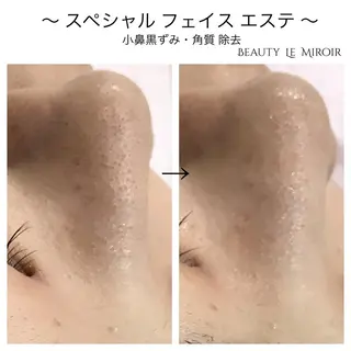 ビューティー ミロワールのエステ・リラクイメージ