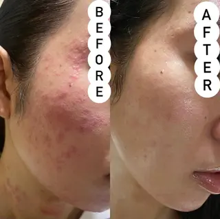 セミロング カラー パーマ ヘアアレンジ メンズ キッズ ネイル マツエク・マツパ NANIOAFU [なんば店］のその他イメージ