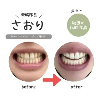 nanami -ホワイトニングのその他イメージ