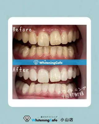 ホワイトニングカフェ 小山店のエステ・リラクイメージ