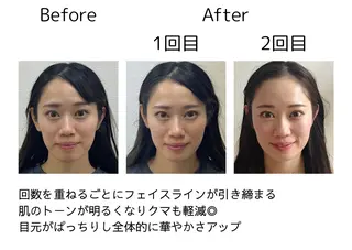 鍼灸師 NARUMIのエステ・リラクイメージ