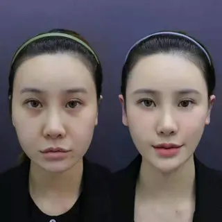 ネイル aliaハーブ水光店 エステティシャン募集のエステ・リラクイメージ