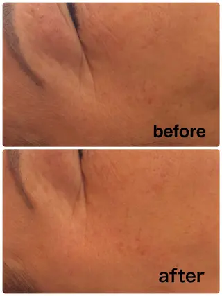 K しずくのエステ・リラクイメージ