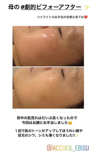 ミディアム カラー パーマ ヘアアレンジ メンズ キッズ ネイル マツエク・マツパ ニキビ・肌質改善専門 ♡人生が変わるサロンのエステ・リラクイメージ