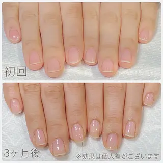 ネイル 赤羽 aura 深爪を断らない✨のネイルデザイン