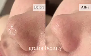 gratia eyelash･nail･beauty所属・gratia salonのエステ・リラクイメージ