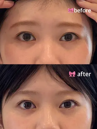 マツエク・マツパ TSUNA 🌙 Lim 五反田のマツエク・マツパデザイン