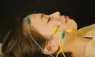 💙美容鍼💙美顔矯 正🧡Brilo🧡のエステ・リラクイメージ