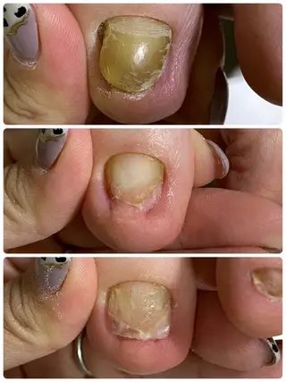 ネイル 丸山 萌奈のネイルデザイン