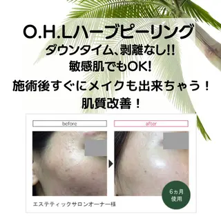 Private salon Leiのエステ・リラクイメージ