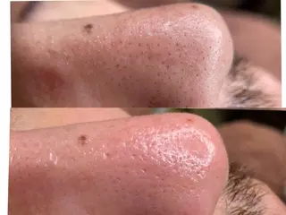 韓国式３D毛穴洗浄＆ 脱毛vive京橋のエステ・リラクイメージ