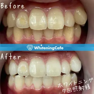 ホワイトニングカフェ 神戸元町店のエステ・リラクイメージ