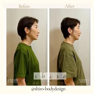 小顔矯正勝山式 shiroしろのエステ・リラクイメージ