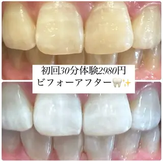 ホワイトニングルーム 横浜店のその他イメージ