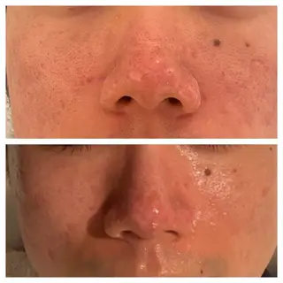 肌質を変えて すっぴん肌に✨のその他イメージ