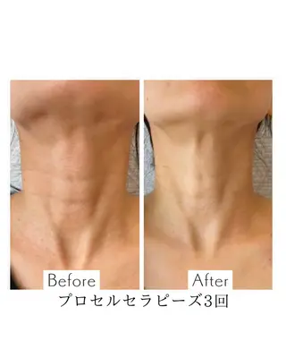 プライベートサロン アオラのネイルデザイン