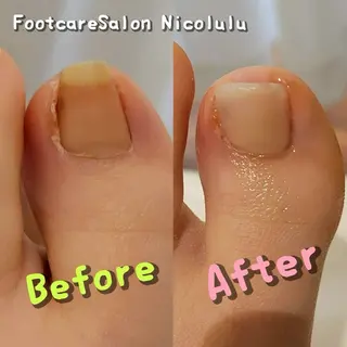 足トラブル専門 ニコルル金沢のエステ・リラクイメージ