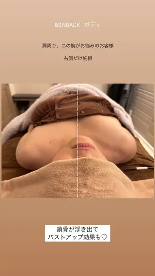 美肌脱毛／ニキビ ／肩こり／慢性疲労のエステ・リラクイメージ