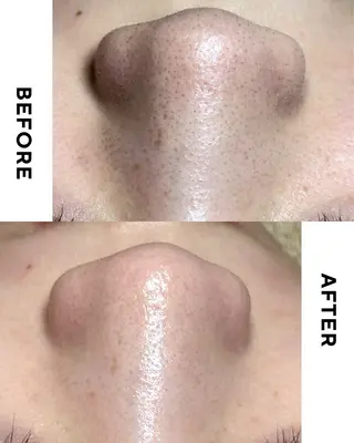 MilleTendresses所属・本町オールハンド リラク/女性専用💐のエステ・リラクイメージ