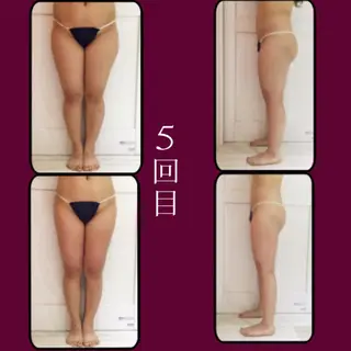 代表 MOMOのエステ・リラクイメージ