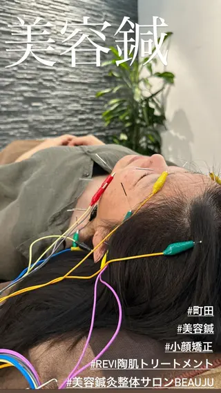 小顔矯/美容鍼/鍼灸 BeauJuのその他イメージ
