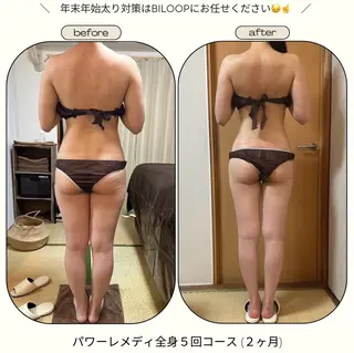 《本気痩せ×疲労改善 》  BILOOPのエステ・リラクイメージ