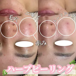 SALON韓国肌管理 東別院のエステ・リラクイメージ