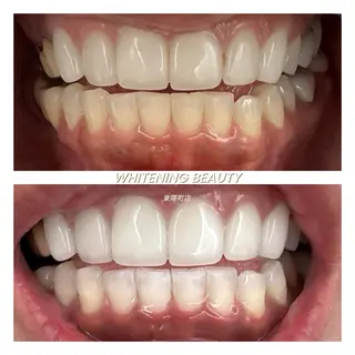 ホワイトニングビューティー東陽町店所属・ホワイトニング ビューティー東陽町店のその他イメージ