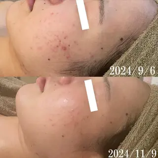 中目黒ハーブピーリン グ🌿ララピールのエステ・リラクイメージ