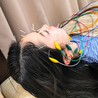お顔のむくみたるみ 専門☆美容鍼小顔矯正のエステ・リラクイメージ