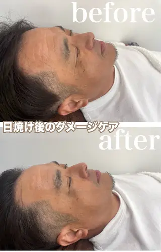 パーソナルスキンケア 🦋APRI🅿️有のエステ・リラクイメージ