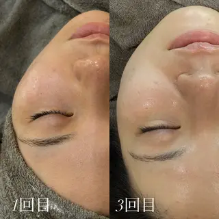 艶肌デトックス🫧 Samiraのエステ・リラクイメージ