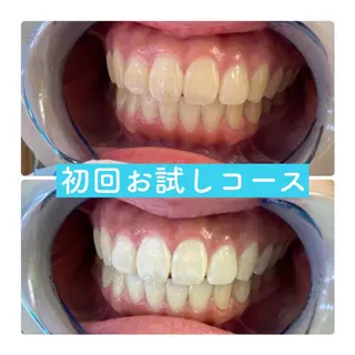 ホワイトニングルーム 横浜店のその他イメージ