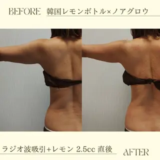 痩身小顔専門 アマテ ビューティー.Nのエステ・リラクイメージ