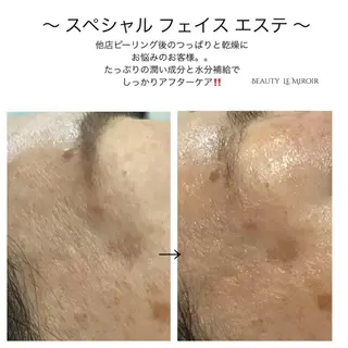 ビューティー ミロワールのエステ・リラクイメージ