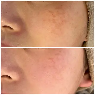 Lassy keikoの眉毛・アイブロウイメージ