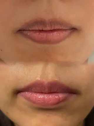 MINI町田所属・【ローマピンク施術】 Kaoのその他イメージ