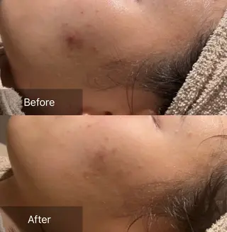 for woman所属・森 美優のエステ・リラクイメージ