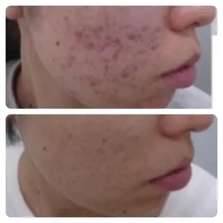 肌質改善専門 鈴木悠のエステ・リラクイメージ