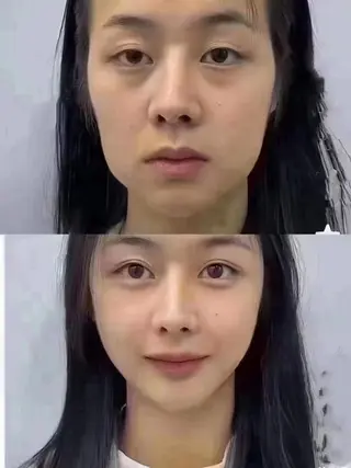 ネイル aliaハーブ水光店 エステティシャン募集のエステ・リラクイメージ