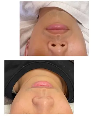 ネイル＆脱毛 Lotus🌸のネイルデザイン