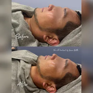 心斎橋🤍堀江.小顔 ハーブ.痩身クレビアのエステ・リラクイメージ