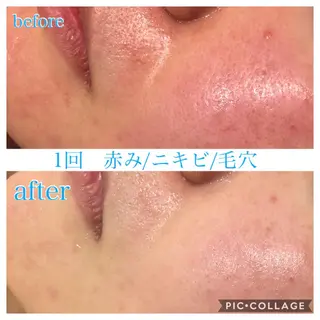 ショート カラー パーマ ヘアアレンジ メンズ キッズ ネイル マツエク・マツパ EnsorClair 代表 野口真央のエステ・リラクイメージ