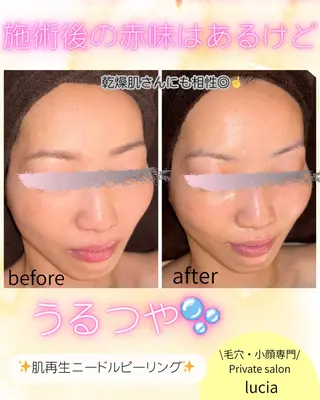 ビューティーサロンルシア所属・lucia  豊明 肌管理のエステ・リラクイメージ