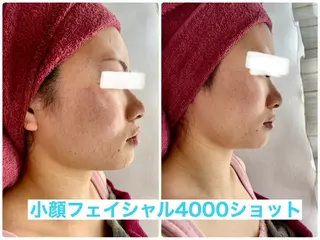 Chalon所属・REVI取扱・肌悩み 毛穴Chalonのエステ・リラクイメージ