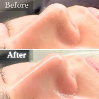 毛穴洗浄特化🫧 オオツカのエステ・リラクイメージ