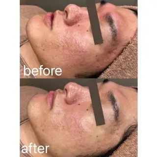 メンズ 【BUB立川】 ゆかのエステ・リラクイメージ